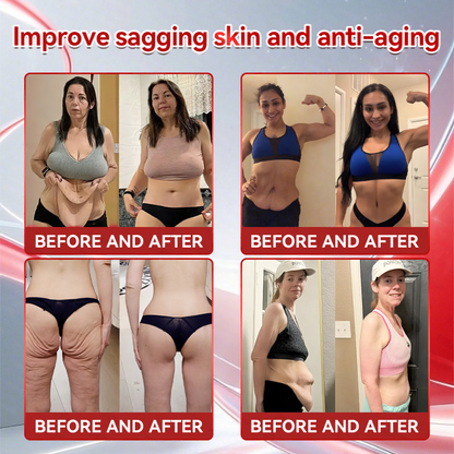 🔥New Arrival | Croaie® 𝑮𝐋𝗣-𝟭 + 𝑪𝒐𝒍𝒍𝙖𝙜𝙚𝙣 𝐏𝐞𝐩𝒕𝒊𝒅𝒆𝒔 𝑾𝒆𝒊𝗴𝗵𝘁 𝐋𝐨𝐬𝐬 & 𝑭𝒊𝒓𝒎𝙞𝙣𝙜 𝑶𝒓𝒂𝐥 𝑺𝒐𝐥𝒖𝒕𝒊𝒐𝒏 💚💚 𝗼𝗯𝗲𝘀𝗶𝘁𝘆, 𝗳𝗶𝗿𝗺𝘀 𝘀𝗸𝗶𝗻, 𝗰𝗮𝗿𝗱𝗶𝗼𝘃𝗮𝘀𝗰𝘂𝗹𝗮𝗿 𝗱𝗶𝘀𝗲𝗮𝘀𝗲, 𝗱𝗶𝗮𝗯𝗲𝘁𝗲𝘀, 𝘀𝗹𝗲𝗲𝗽 𝗮𝗽𝗻𝗲𝗮, 𝗷𝗼𝗶𝗻𝘁 𝗽𝗿𝗼𝗯𝗹𝗲𝗺𝘀, 𝗮𝗻𝗱 𝗺𝗼𝗿𝗲