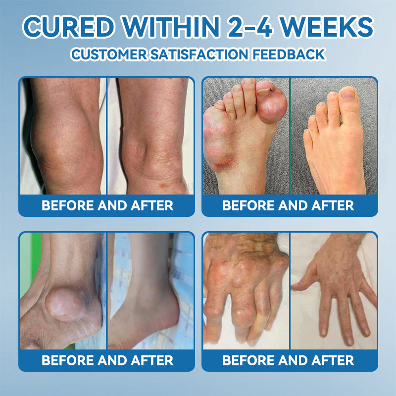 LOTMAY® BPC-157 Joint & Muscle Treatment Cream🦴Treats Arthritis, Neuropathy, Rheumatism, Sports Injuries & More 🌹