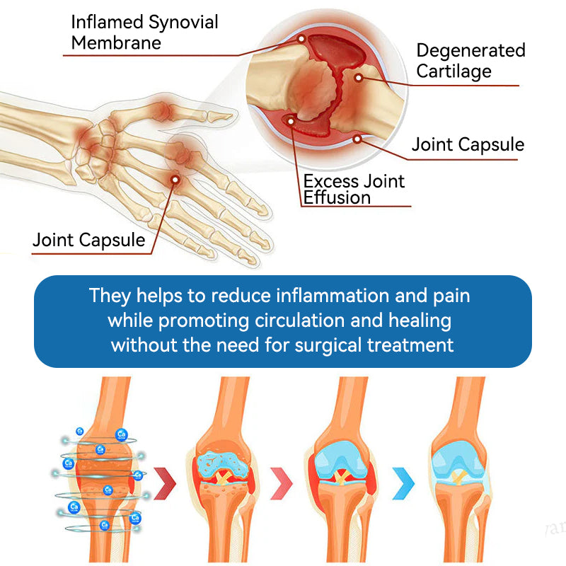 LOTMAY® BPC-157 Joint & Muscle Treatment Cream🦴Treats Arthritis, Neuropathy, Rheumatism, Sports Injuries & More 🌹