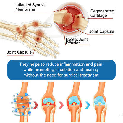 LOTMAY® BPC-157 Joint & Muscle Treatment Cream🦴Treats Arthritis, Neuropathy, Rheumatism, Sports Injuries & More 🌹