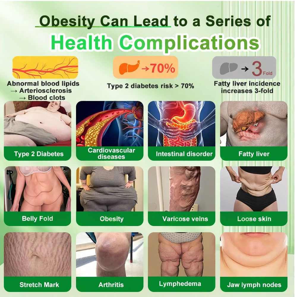 🔥New Arrival  Croaie® 𝗚𝗟𝗣-𝟭 𝟐𝟎-𝐢𝐧-𝟏 𝐒𝐥𝐢𝐦 & 𝐇𝐞𝐚𝐥𝐭𝐡 𝐎𝐫𝐚𝐥 𝐒𝐨𝐥𝐮𝐭𝐢𝐨𝐧 -𝑶𝒏𝒄𝒆 𝒂 𝒅𝒂𝒚, 𝒓𝒆𝒔𝒖𝒍𝒕𝒔 𝒊𝒏 6 𝒅𝒂𝒚𝒔, 𝑾𝒊𝒕𝒉 100 𝑩𝒊𝒍𝒍𝒊𝒐𝒏 𝑪𝑭𝑼 𝑨𝒄𝒕𝒊𝒗𝒆 𝑷𝒓𝒐𝒃𝒊𝒐𝒕𝒊𝒄𝒔 ✅ 𝑺𝒖𝒑𝒑𝒐𝒓𝒕𝒔 𝒘𝒆𝒊𝒈𝒉𝒕 𝒎𝒂𝒏𝒂𝒈𝒆𝒎𝒆𝒏𝒕, 𝒉𝒆𝒂𝒓𝒕 𝒉𝒆𝒂𝒍𝒕𝒉, 𝒅𝒊𝒂𝒃𝒆𝒕𝒆𝒔, 𝒈𝒖𝒕 & 𝒘𝒐𝒎𝒆𝒏’𝒔 𝒉𝒆𝒂𝒍𝒕𝒉, 𝒘𝒉𝒊𝒍𝒆 𝒇𝒊𝒓𝒎𝒊𝒏𝒈 𝒔𝒌𝒊𝒏