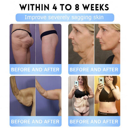 FDA Official Store | Myo Clinic GLP-1 Slim & Firm Nano Microneedle Patch with Collagen, Turmeric & Matrixyl 3000丨Obesity, Cardiovascular Disease, Diabetes, Sleep Apnea, Joint Problems and More