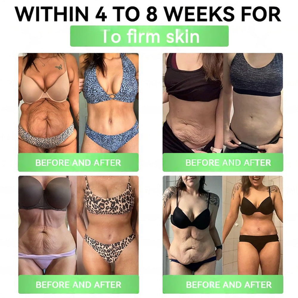 🏥𝑶𝒏𝒍𝒊𝒏𝒆 𝑷𝒉𝒂𝒓𝒎𝒂𝒄𝒚 | 𝑯𝒐𝒏𝒙𝒊® 𝑮𝑳𝑷-𝟏 + 𝑺𝑮𝑳𝑻-𝟐𝒊 𝗦𝗹𝗶𝗺 & 𝑯𝒆𝒂𝒍𝒕𝒉 𝑶𝒓𝒂𝒍 𝑺𝒐𝒍𝒖𝒕𝒊𝒐𝒏 (𝑂𝑛𝑐𝑒 𝑎 𝑑𝑎𝑦, 𝑣𝑖𝑠𝑖𝑏𝑙𝑒 𝑟𝑒𝑠𝑢𝑙𝑡𝑠 𝑖𝑛 7 𝑑𝑎𝑦𝑠) ✅𝗦𝘂𝗽𝗽𝗼𝗿𝘁𝘀 𝗼𝗯𝗲𝘀𝗶𝘁𝘆, 𝗰𝗮𝗿𝗱𝗶𝗼𝘃𝗮𝘀𝗰𝘂𝗹𝗮𝗿 𝗵𝗲𝗮𝗹𝘁𝗵, 𝗱𝗶𝗮𝗯𝗲𝘁𝗲𝘀, 𝘀𝗹𝗲𝗲𝗽 𝗮𝗽𝗻𝗲𝗮, 𝗴𝘂𝘁 𝗵𝗲𝗮𝗹𝘁𝗵, 𝗷𝗼𝗶𝗻𝘁 𝗶𝘀𝘀𝘂𝗲𝘀, 𝐰𝐡𝐢𝐥𝐞 𝐚𝐥𝐬𝐨 𝐟𝐢𝐫𝐦𝐢𝐧𝐠 𝐭𝐡𝐞 𝐬𝐤𝐢𝐧 𝐚𝐧𝐝 𝐛𝐨𝐨𝐬𝐭𝐢𝐧𝐠 𝐞𝐧𝐞𝐫𝐠🥰