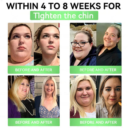 🇬🇧𝑶𝒏𝒍𝒊𝒏𝒆 𝑷𝒉𝒂𝒓𝒎𝒂𝒄𝒚 | 𝑯𝒐𝒏𝒙𝒊®✨ 𝑮𝑳𝑷-𝟏 + 𝑺𝑮𝑳𝑻-𝟐𝒊 𝗦𝗹𝗶𝗺 & 𝑯𝒆𝒂𝒍𝒕𝒉 𝑶𝒓𝒂𝒍 𝑺𝒐𝒍𝒖𝒕𝒊𝒐𝒏 (𝑂𝑛𝑐𝑒 𝑎 𝑑𝑎𝑦, 𝑣𝑖𝑠𝑖𝑏𝑙𝑒 𝑟𝑒𝑠𝑢𝑙𝑡𝑠 𝑖𝑛 7 𝑑𝑎𝑦𝑠) ✅𝗦𝘂𝗽𝗽𝗼𝗿𝘁𝘀 𝗼𝗯𝗲𝘀𝗶𝘁𝘆, 𝗰𝗮𝗿𝗱𝗶𝗼𝘃𝗮𝘀𝗰𝘂𝗹𝗮𝗿 𝗵𝗲𝗮𝗹𝘁𝗵, 𝗱𝗶𝗮𝗯𝗲𝘁𝗲𝘀, 𝘀𝗹𝗲𝗲𝗽 𝗮𝗽𝗻𝗲𝗮, 𝗴𝘂𝘁 𝗵𝗲𝗮𝗹𝘁𝗵, 𝗷𝗼𝗶𝗻𝘁 𝗶𝘀𝘀𝘂𝗲𝘀, 𝐰𝐡𝐢𝐥𝐞 𝐚𝐥𝐬𝐨 𝐟𝐢𝐫𝐦𝐢𝐧𝐠 𝐭𝐡𝐞 𝐬𝐤𝐢𝐧 𝐚𝐧𝐝 𝐛𝐨𝐨𝐬𝐭𝐢𝐧𝐠 𝐞𝐧𝐞𝐫𝐠𝐲