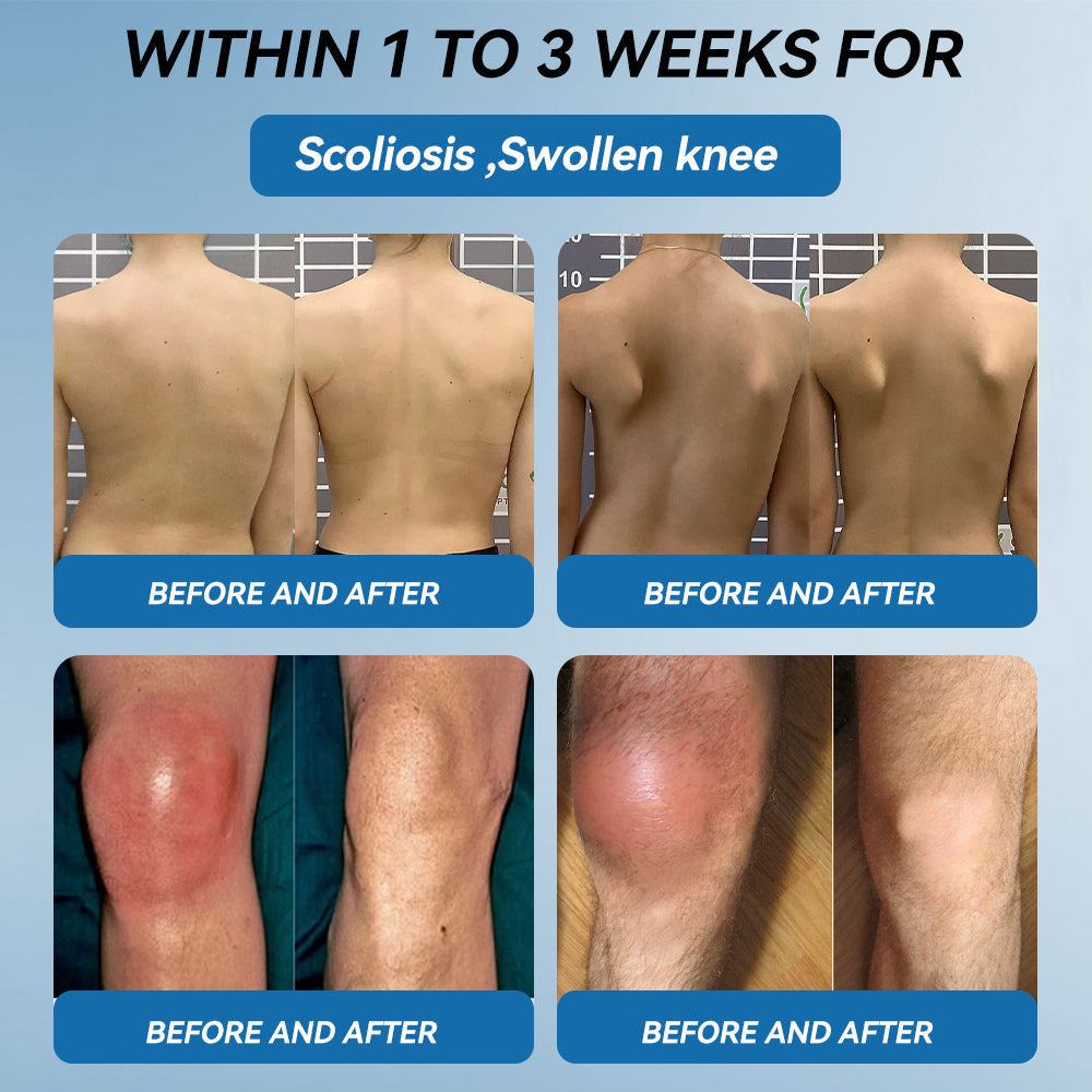 LOTMAY® BPC-157 Joint & Muscle Treatment Cream🦴Treats Arthritis, Neuropathy, Rheumatism, Sports Injuries & More 🌹