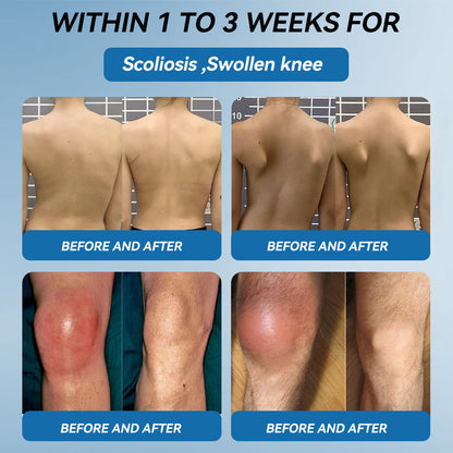 LOTMAY® BPC-157 Joint & Muscle Treatment Cream🦴Treats Arthritis, Neuropathy, Rheumatism, Sports Injuries & More 🌹