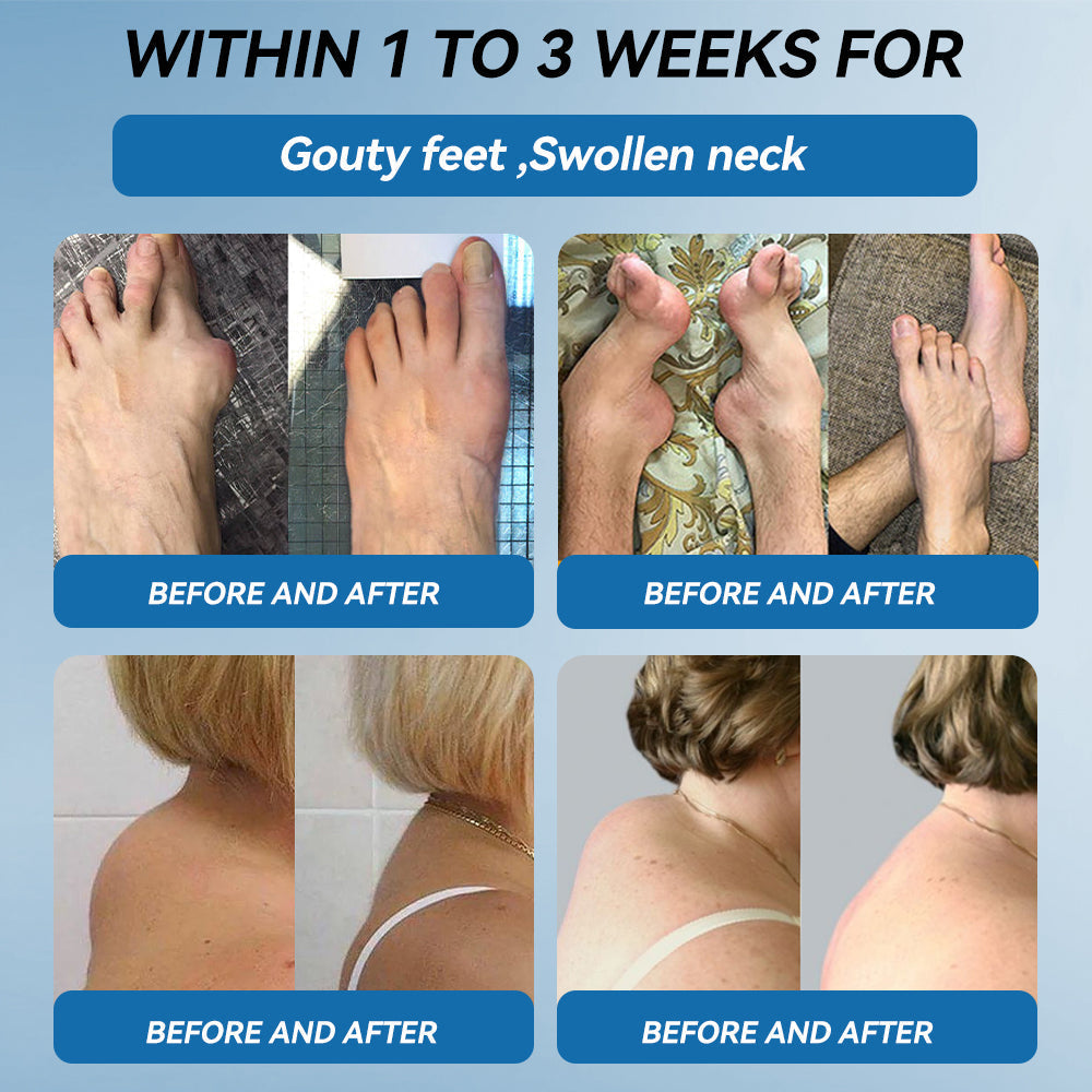 LOTMAY® BPC-157 Joint & Muscle Treatment Cream🦴Treats Arthritis, Neuropathy, Rheumatism, Sports Injuries & More 🌹